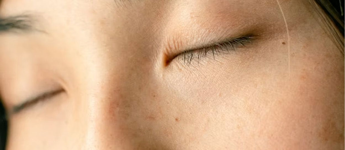 Bettwäsche und Allergien: Welches Material sollte man bei empfindlicher Haut wählen? – Kipli