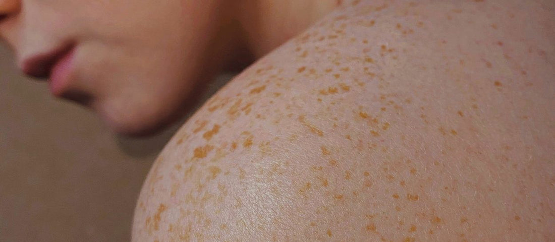 Naturlatexmatratzen und Allergien: Die Wahrheit über Hausstaubmilben